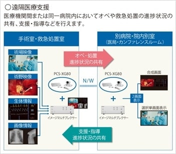 遠隔医療支援